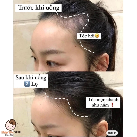 Viên uống Biotin 10.000mcg của Mỹ 100 viên ( Hỗ trợ mọc tóc, giảm gãy rụng tóc)