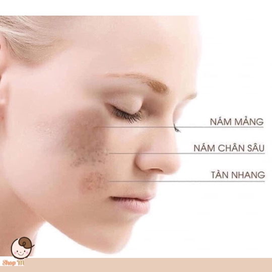 Serum collagen tươi Aeoron 108 viên của Úc ( Dưỡng trắng - chỗng lão hoá - thu nhỏ chân lông)