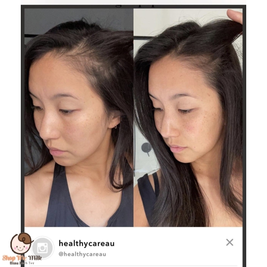 Viên Beauty Collagen 1000mg Úc hộp 60 viên ( Hỗ trợ da, tóc, móng)
